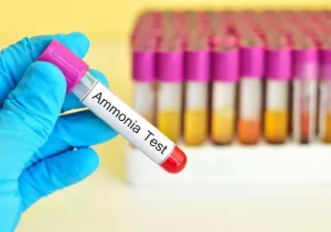 Penggunaan Ammonia dalam Industri farmasi